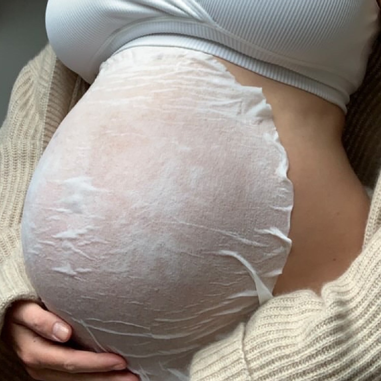 The Pregnancy Stretch Mark Duo