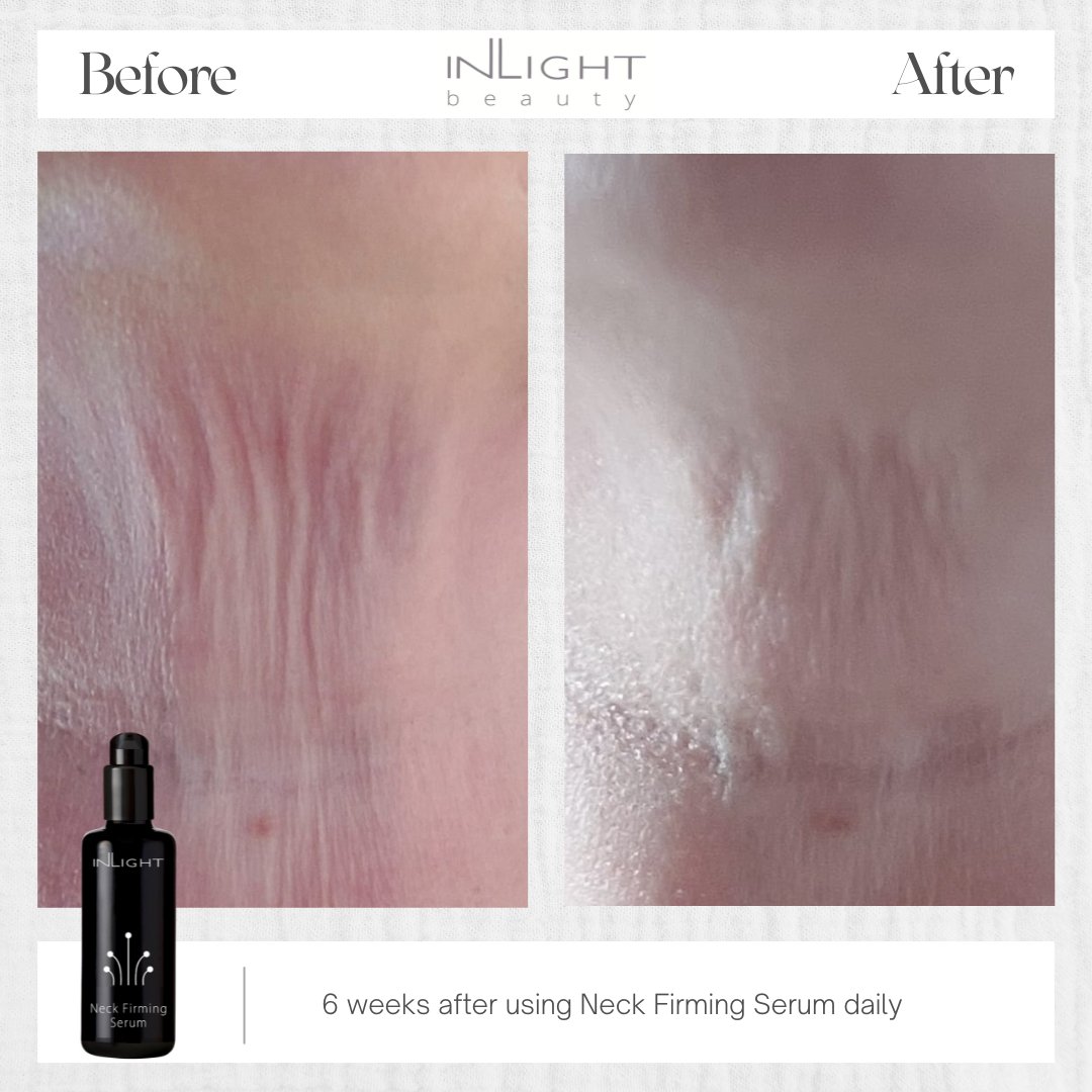 Neck Firming Serum 50ml