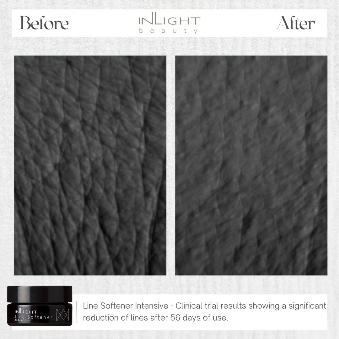 Line Softener Intensive 15ml